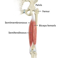 Hamstring Repair